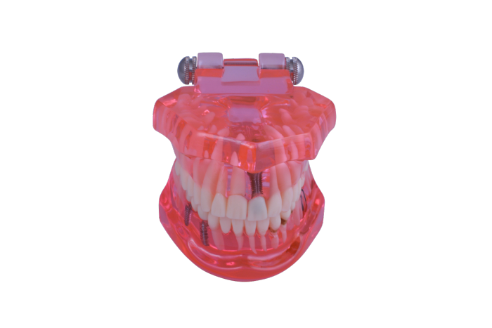 3D Dental Teaching Model